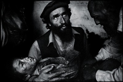 Zranení chlapec po spojeneckých náletech v Afgánistánu. Foto: Flickr